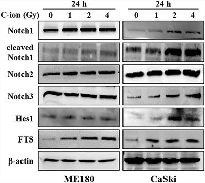 Silencing of Fused Toes Homolog (FTS) Increases Radiosensitivity to Carbon-Ion Through Downregulation of Notch Signaling in Cervical Cancer Cells